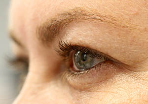 olhos.mutirao.catarata.VP