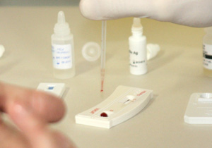 Saúde intensifica testes rápidos de DST 